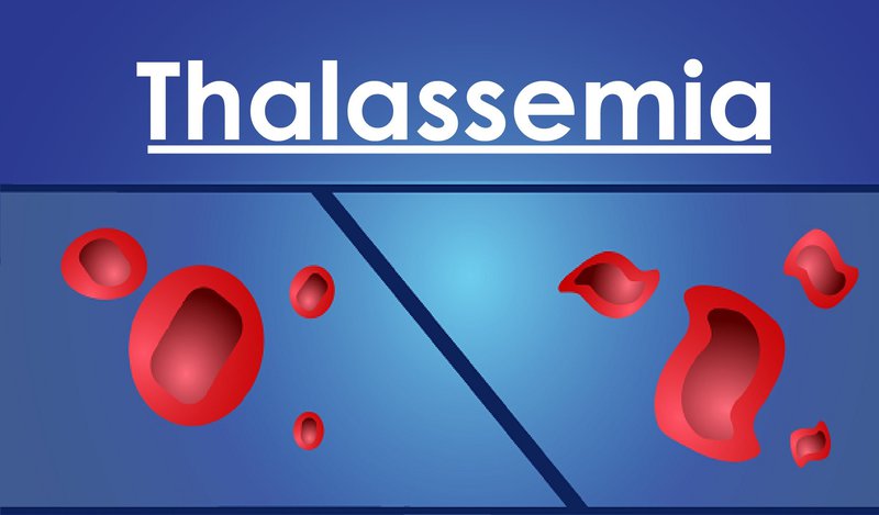Bệnh tan máu bẩm sinh - Thalassemia